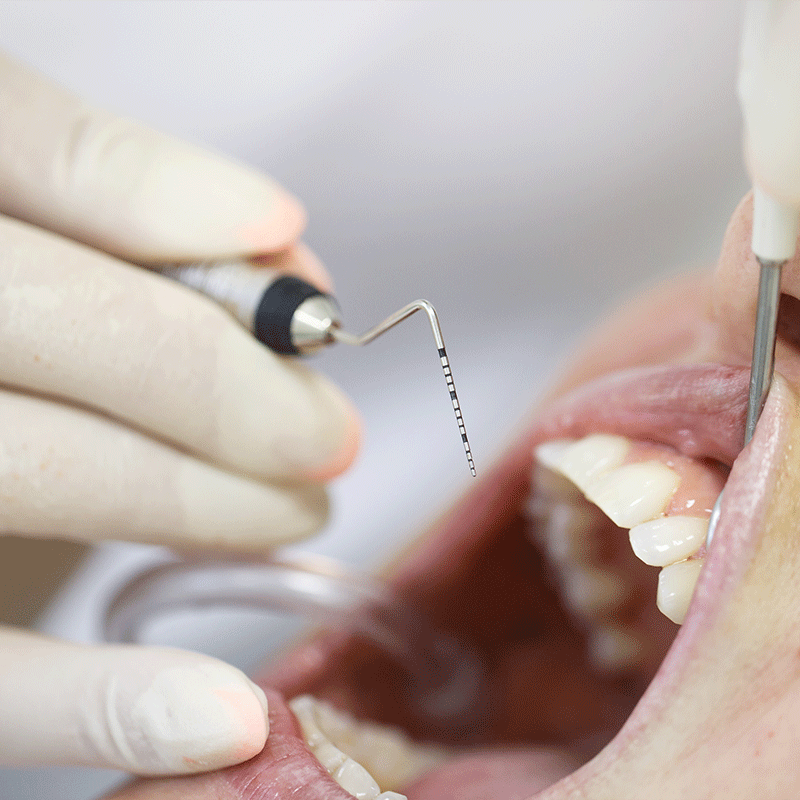 Careum Dentalhygiene Zahnbehandlung